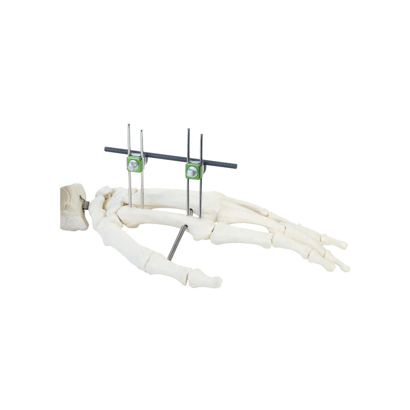 Phalanges of fingers & metacarpal bones frame (double-pin