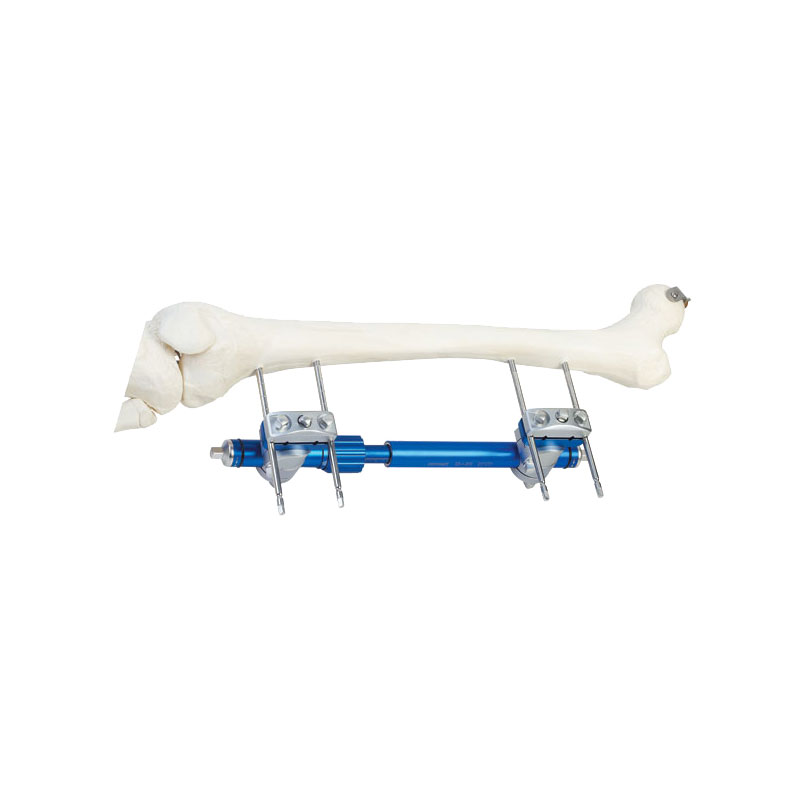 Thighbone pressure connecting rod frame