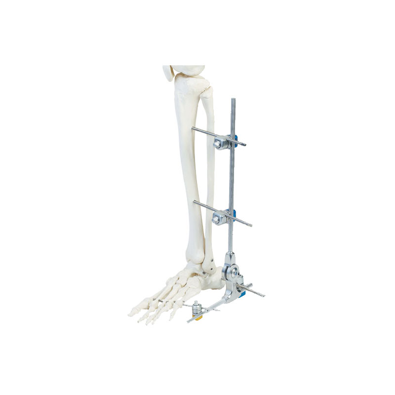 Ankle joint frame